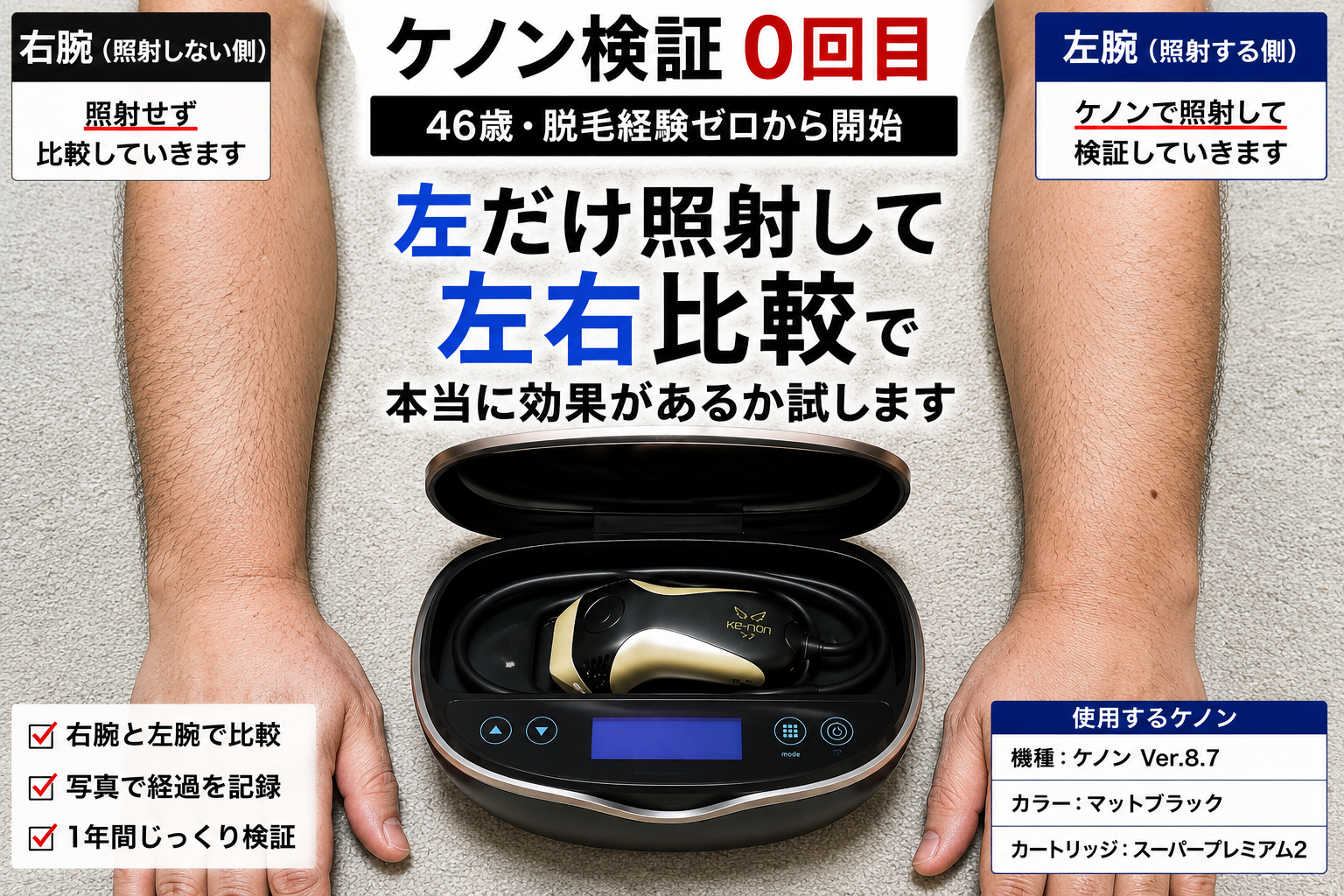 ケノン検証0回目｜46歳男性が左腕だけ照射して右腕と左右比較