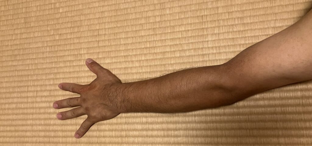 ケノン検証開始前の左腕のムダ毛｜46歳男性・剃毛前
